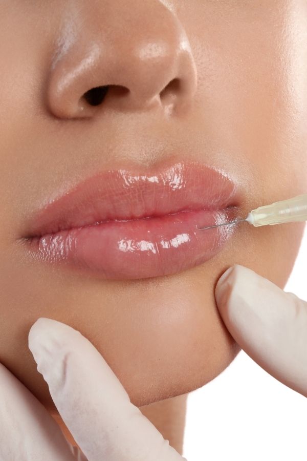 2. Voluminización de labios