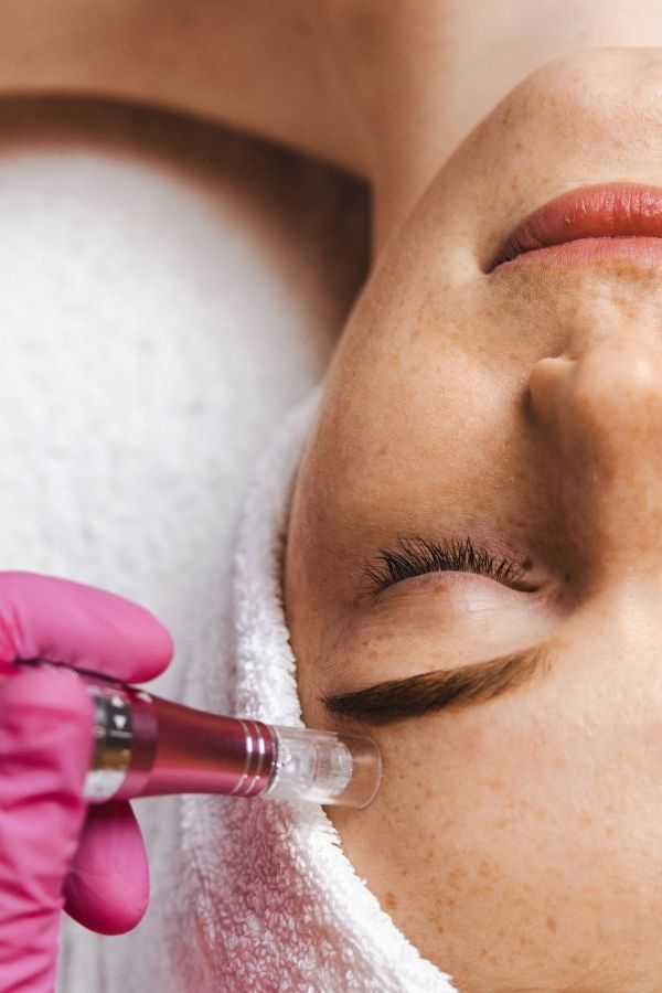 6. Microneedling
